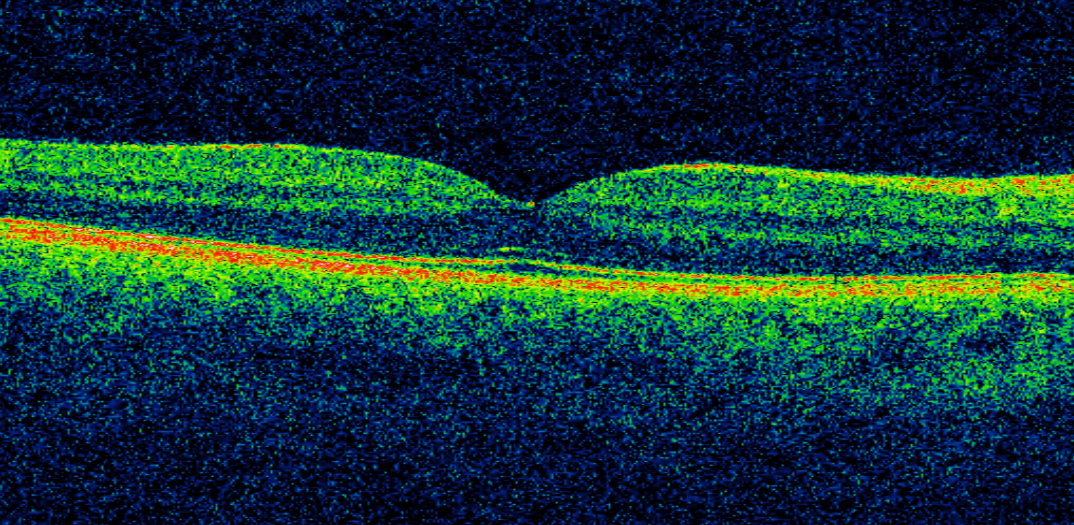 An image of the retina.