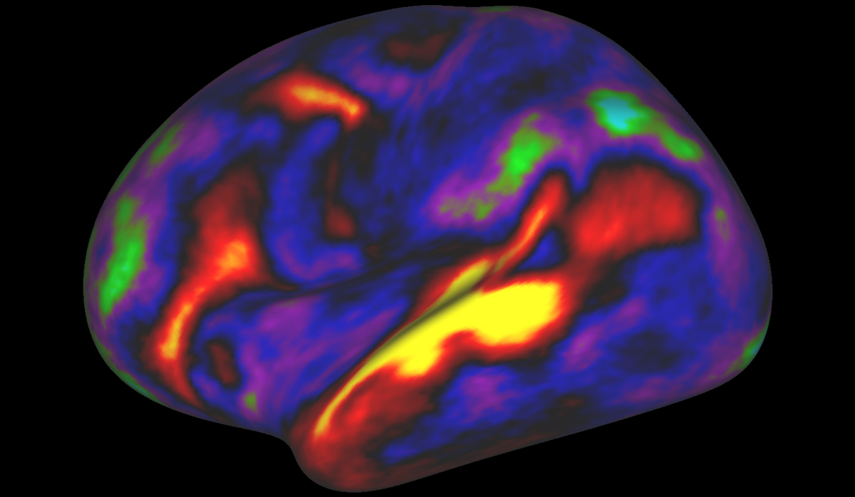 Researchers used an MRI scanner to watch brain activity while participants listened to stories. Red and yellow indicate regions of activation.