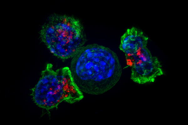T-cells surround a cancer cell.