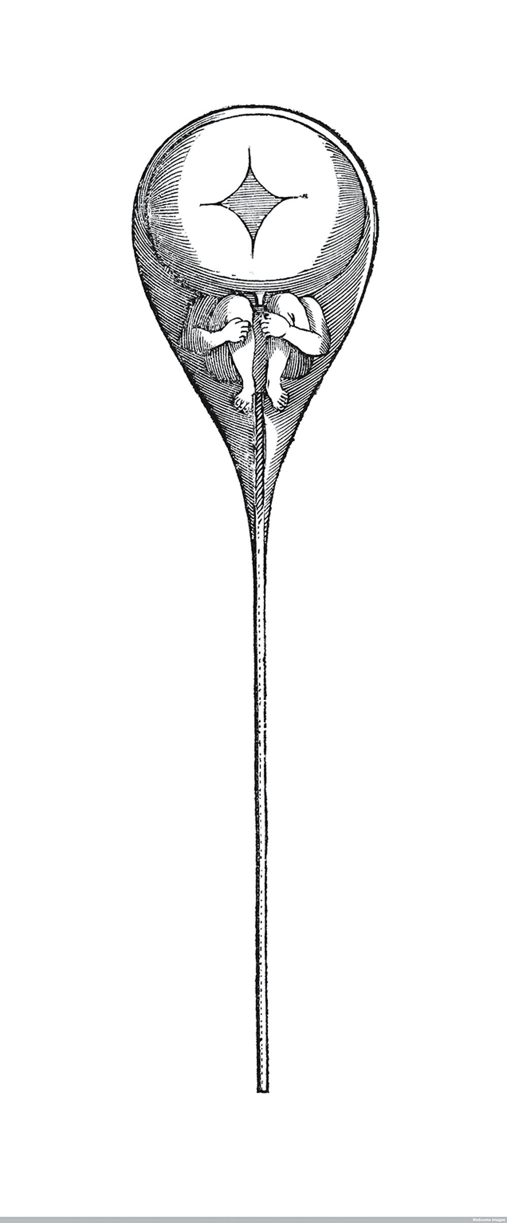 Sperm containing a homunculus (Nicholas Hartsoeker, 1695).