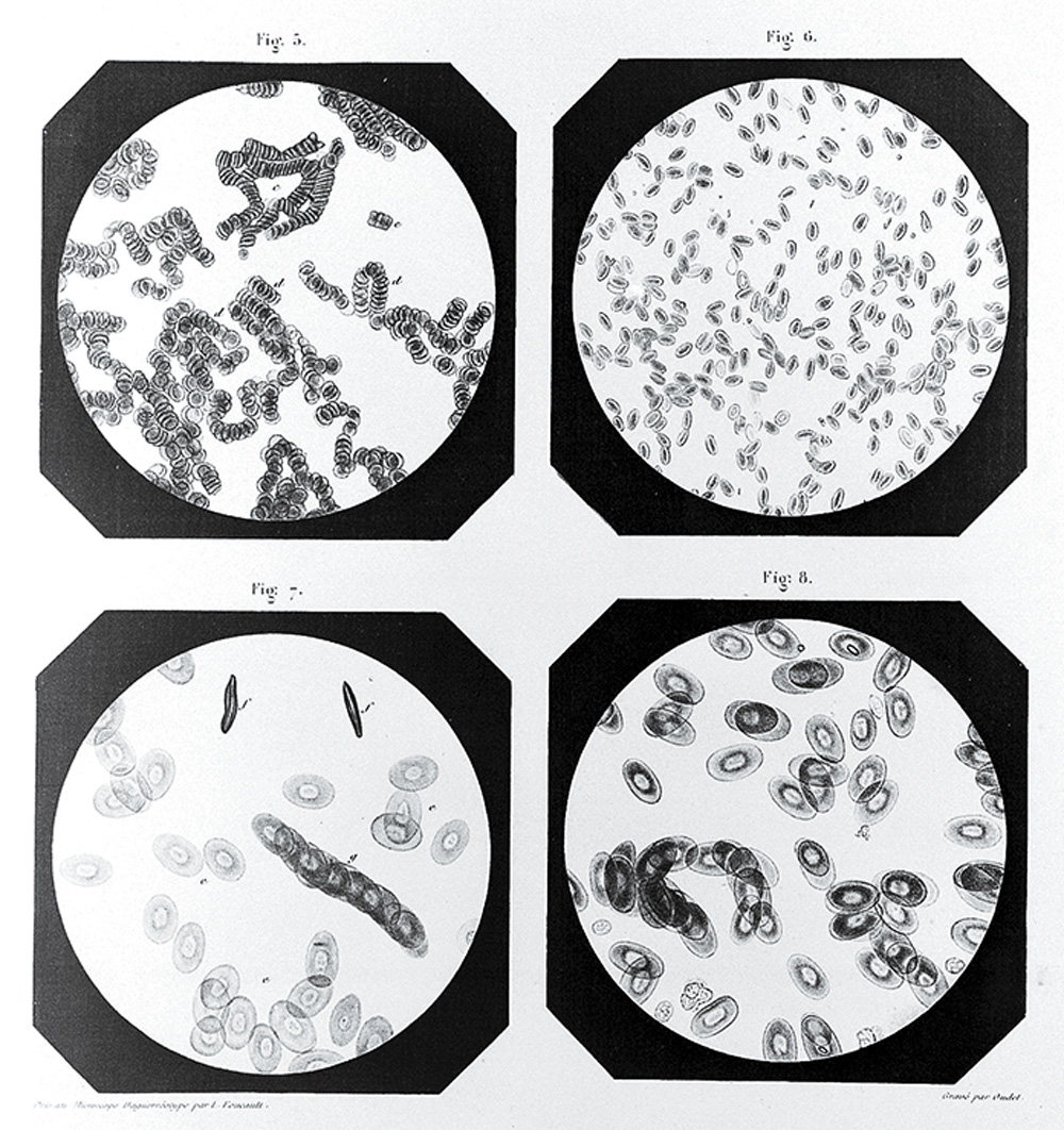 Daguerreotypes of blood from humans, camels, and toads (A. Donné, 1845).