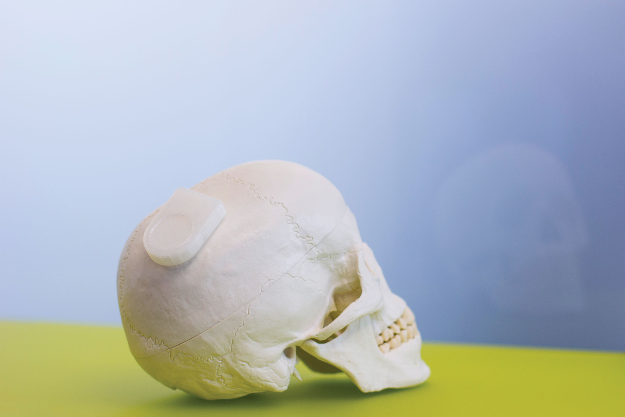 A model of a wireless neurocommunication device sits on a skull.