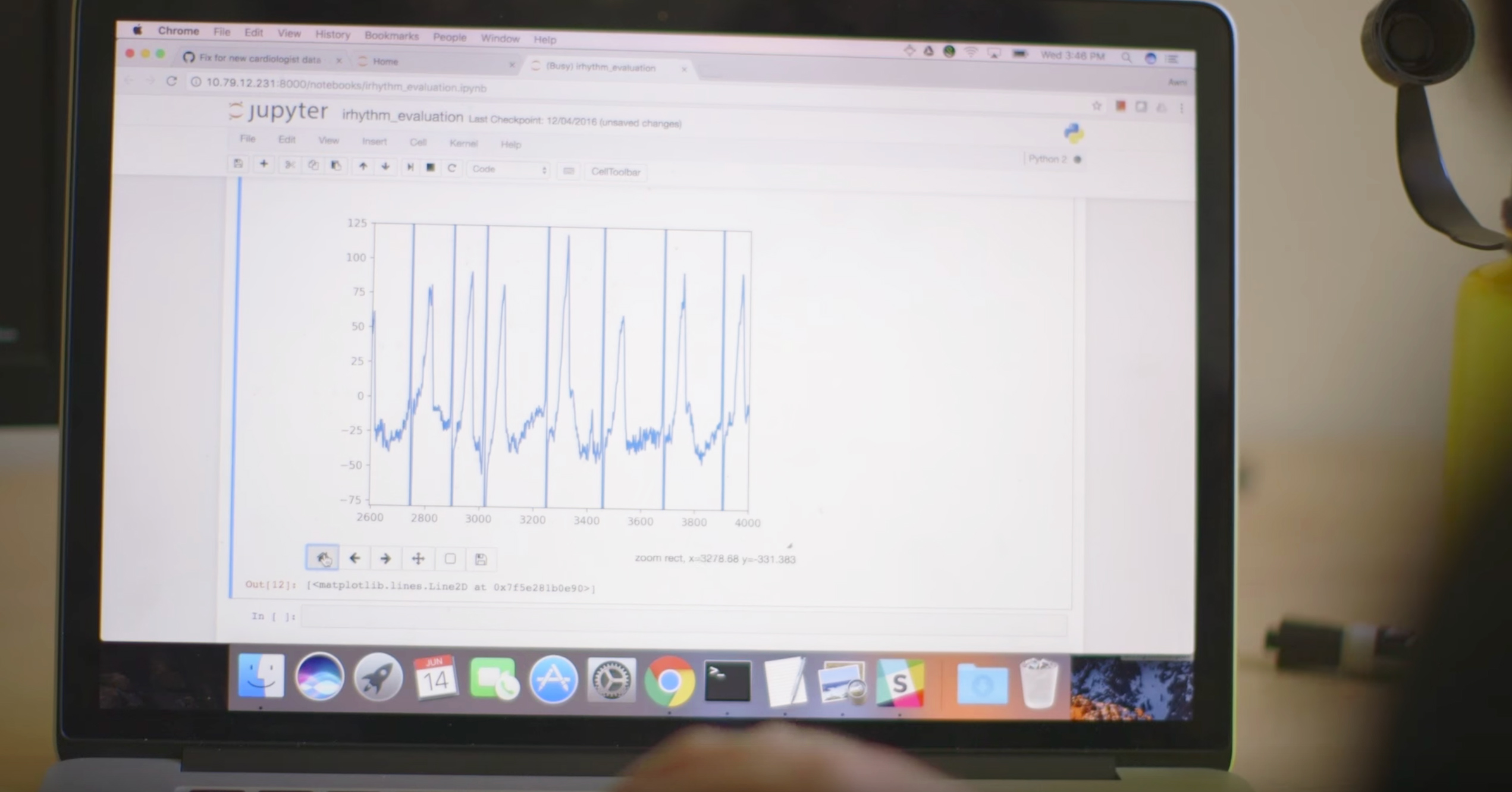 The Stanford researchers trained a deep-learning algorithm to identify different types of irregular heartbeats from the ECG data.