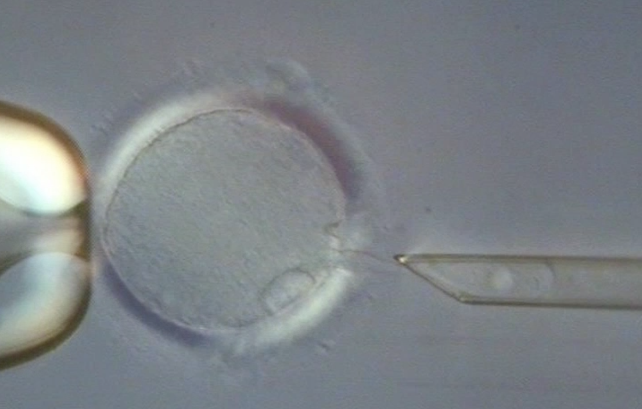 In a technique, created by John Zhang, called spindle nuclear transfer, the nucleus of a donor egg is removed and the DNA of another woman's egg is injected.