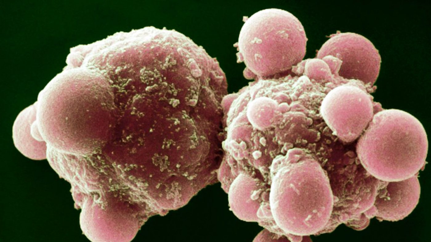 MIT Tech Review: 老化細胞を殺すアンチエイジング薬「セノリティクス