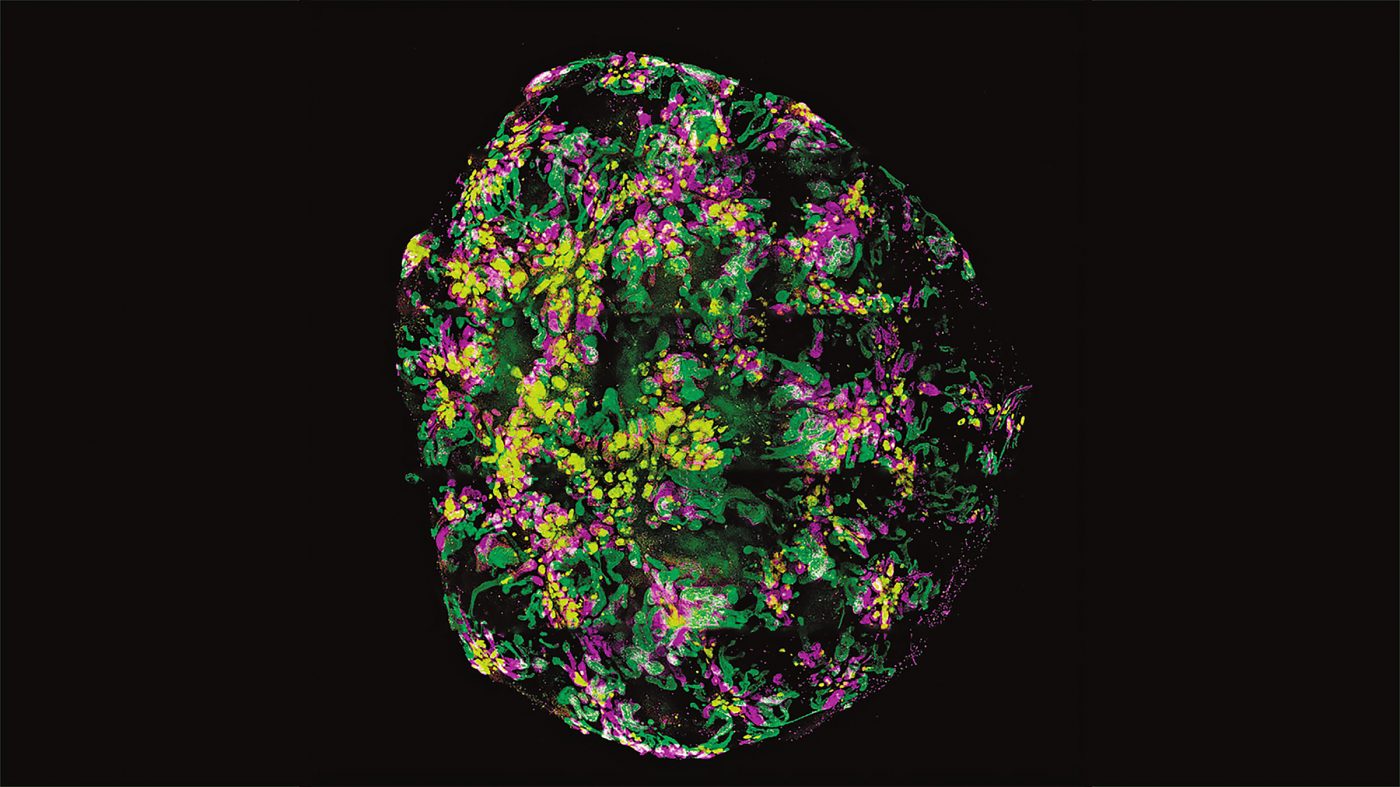 A-kidney-organoid-generated-