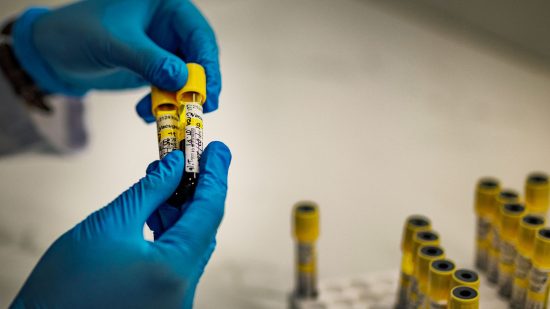 1日あたり乳幼児1400人にHIV感染リスク、米対外援助停止で