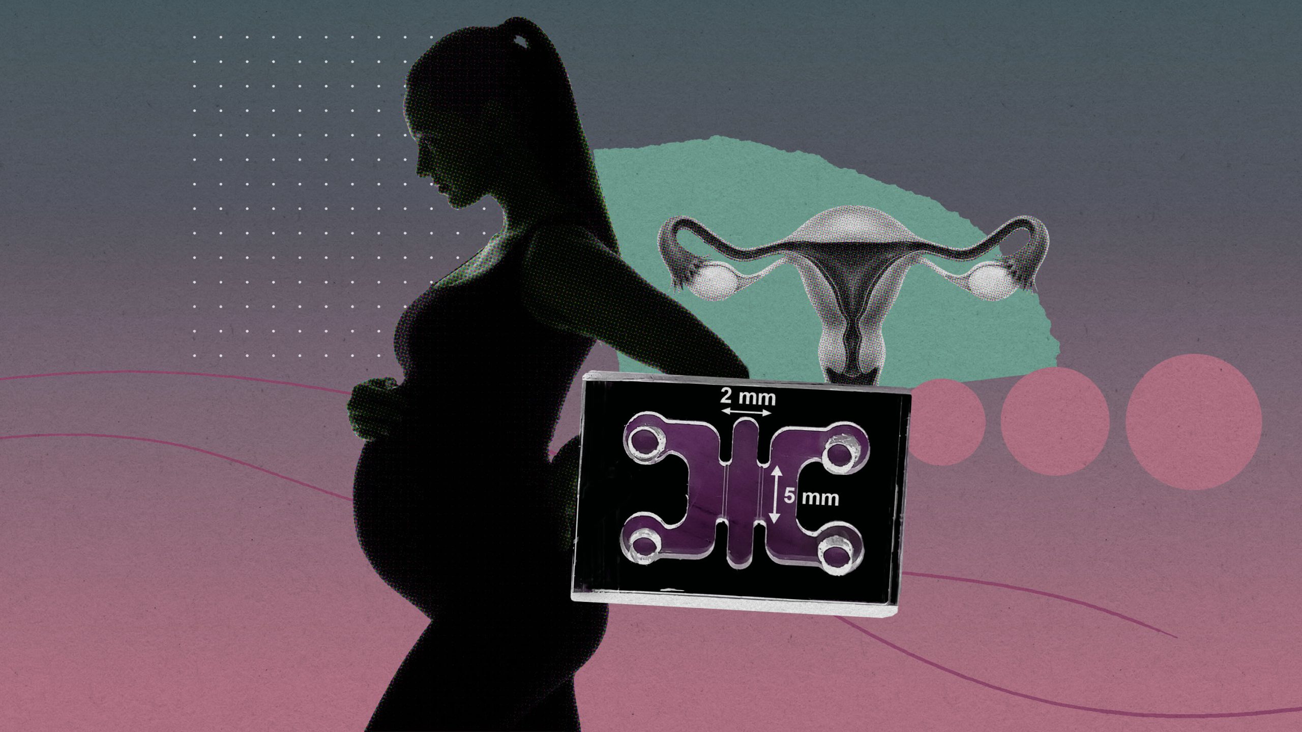 体外受精から「体外着床」へ、オルガノイドで妊娠初期を再現